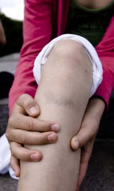 Lihasten peruskunto on terveydelle tärkeää.