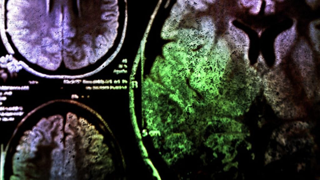 Neurologiset vammat voivat tuntua pelottavilta.