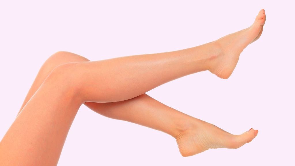 Suonikohjut ovat yleinen vaiva. Kuvituskuva.