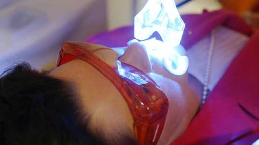 Hampaiden valkaisun suosio on kasvussa.