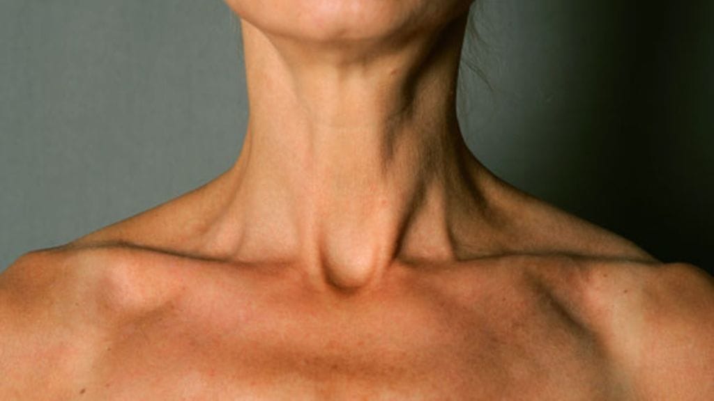 Hengittämisen pitäisi lähteä palleasta, ei rintakehästä. Kuvituskuva.