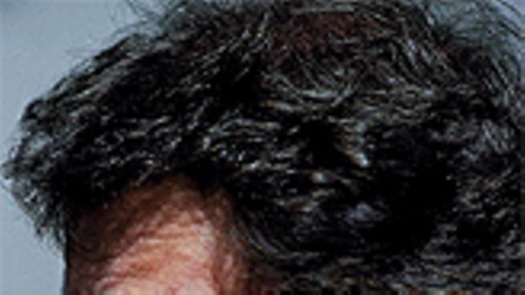 Norbert Haug, Photo: Robert Cianflone /Allsport