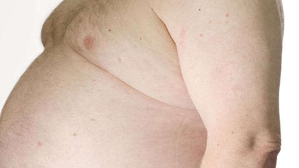 Katso kuvat maailman lihavimmasta miehestä jutun alla olevasta linkistä. Kuvituskuva.