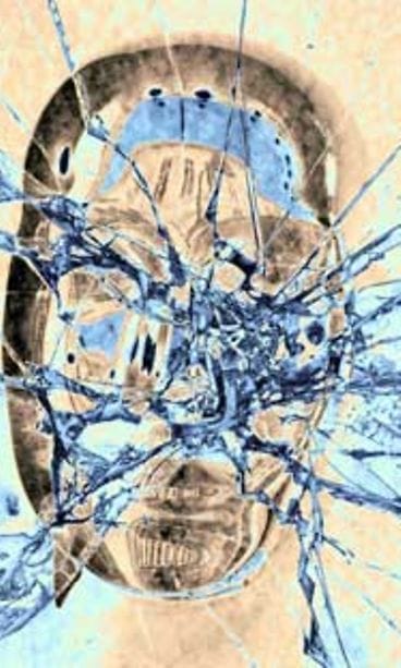 Kipupotilas tarvitsee tukea.