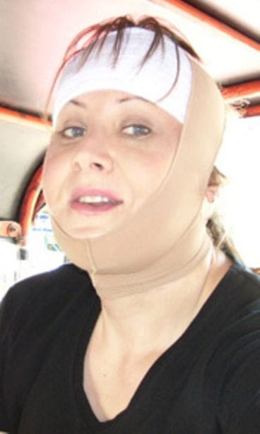 Milla kävi korjauttamassa kasvonpiirteitäänBangkokissa.