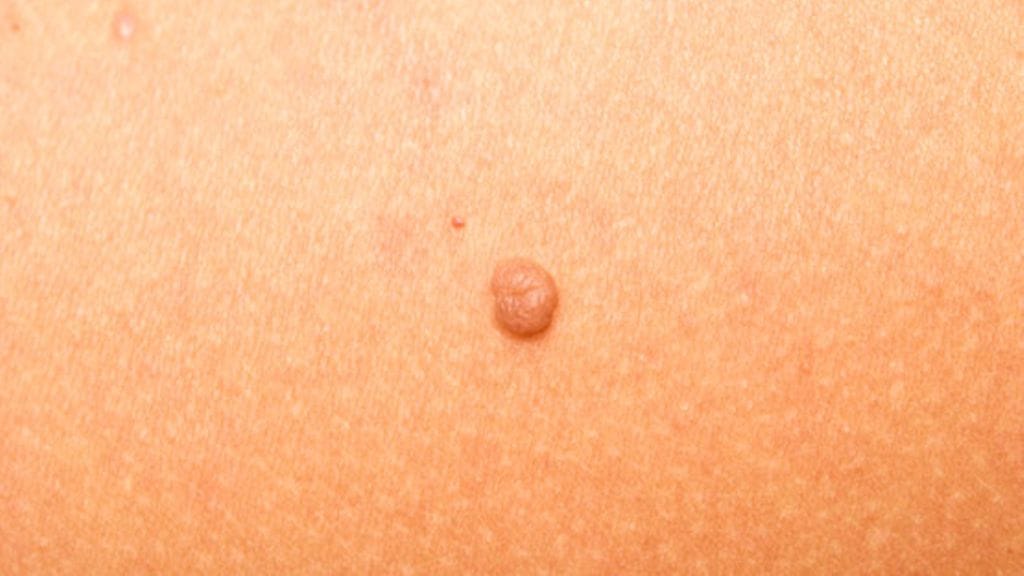 Ihossa tapahtuvista muutoksista tulee pysyä ajan tasalla.