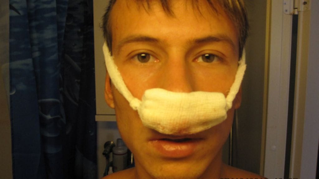 BB-Antti