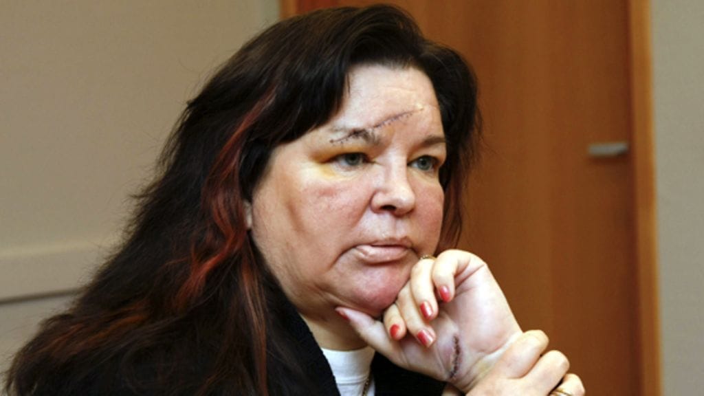 Mervi Tapola-Nykänen puukotuksen jälkeen vuonna 2009. (Kuva: Lehtikuva)