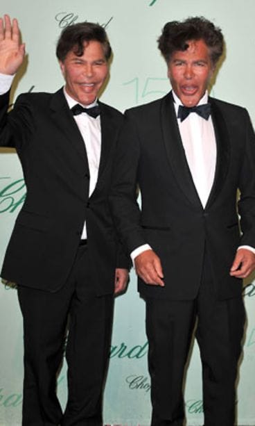 Igor ja Grichka Bogdanoffin ulkonäkö järkyttää. (Kuva: Getty Images)