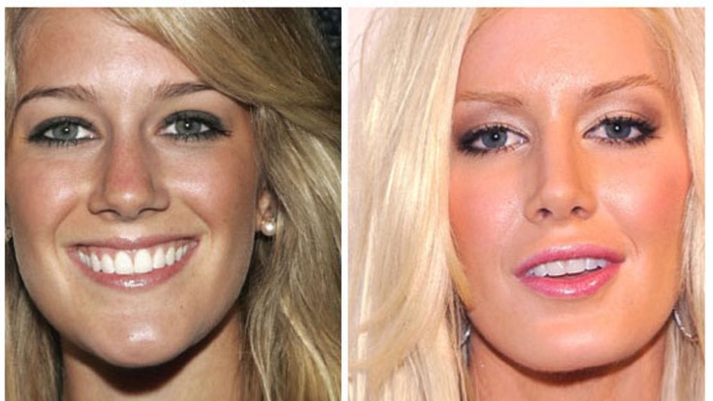 Hills-tähti Heidi Montag. (Kuva: GettyImages)