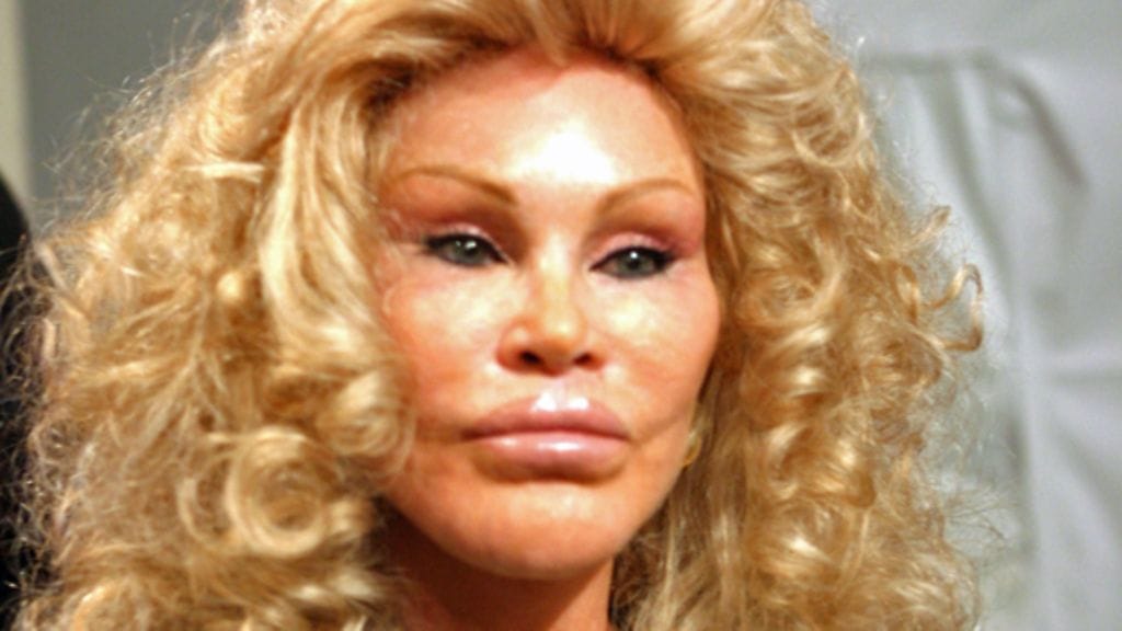 Jocelyn Wildenstein (Getty)