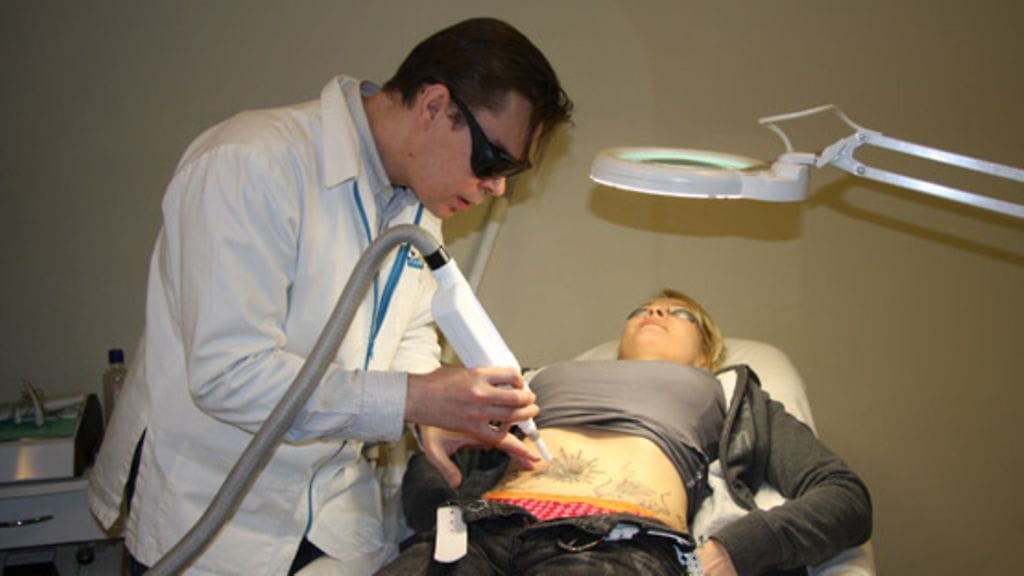 Tomi Anttilainen vaalentaa Siirin tatuointia laserilla.