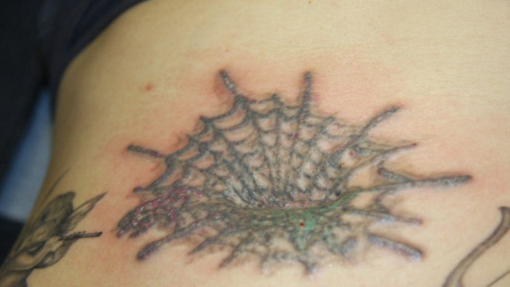 Siiri Mustosen tatuointi laserhoidon jälkeen.