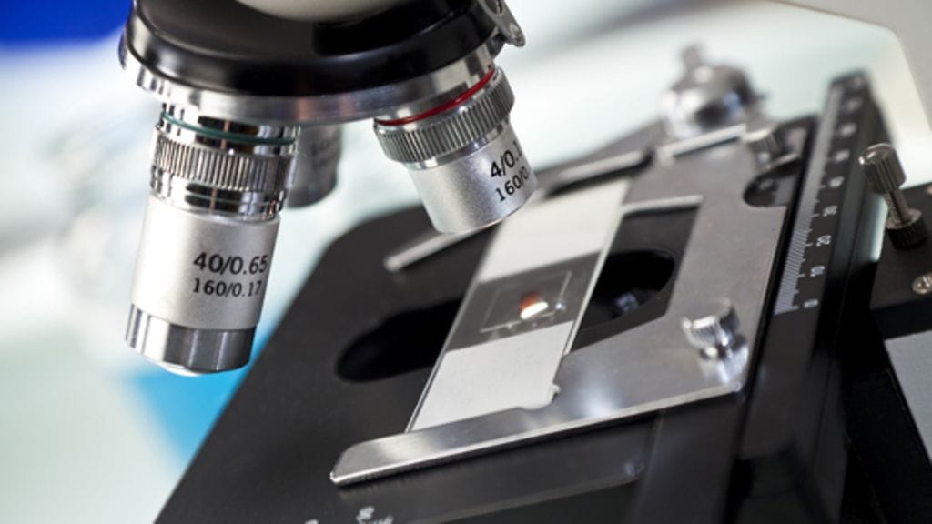 Tieteen edistysaskeleet tuovat toivoa eturauhassyöpäpotilaille. Kuvituskuva.