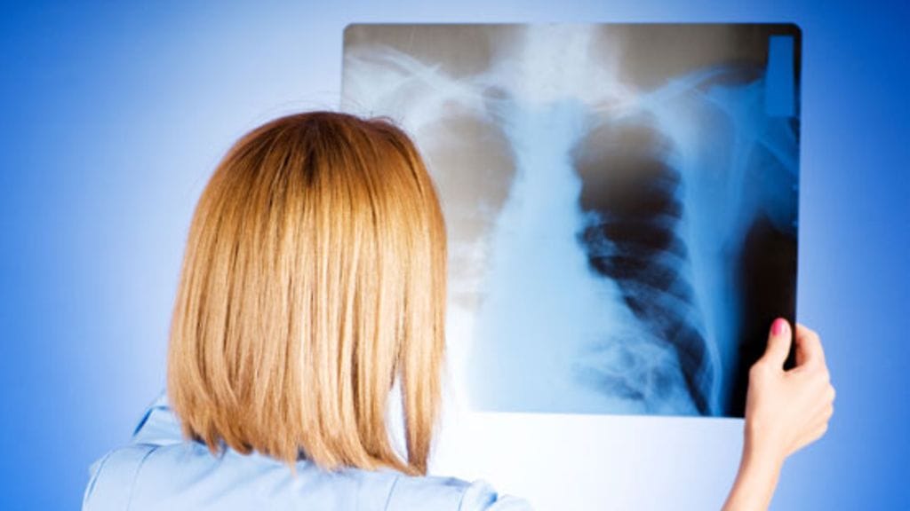 Petteri Punakuono ilmestyi aivokuviin. Tämä kuva ei liity tapaukseen.