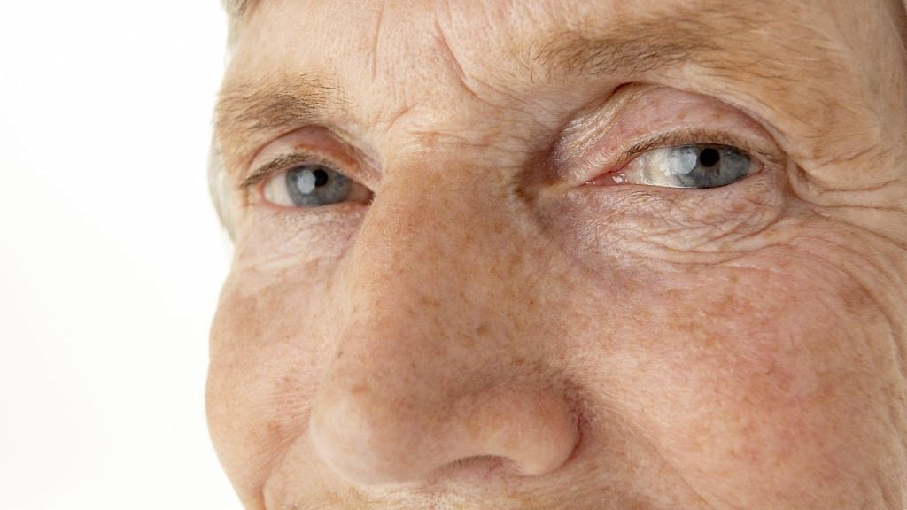 Riski kaihiin lisääntyy iän myötä. Kuvituskuva.