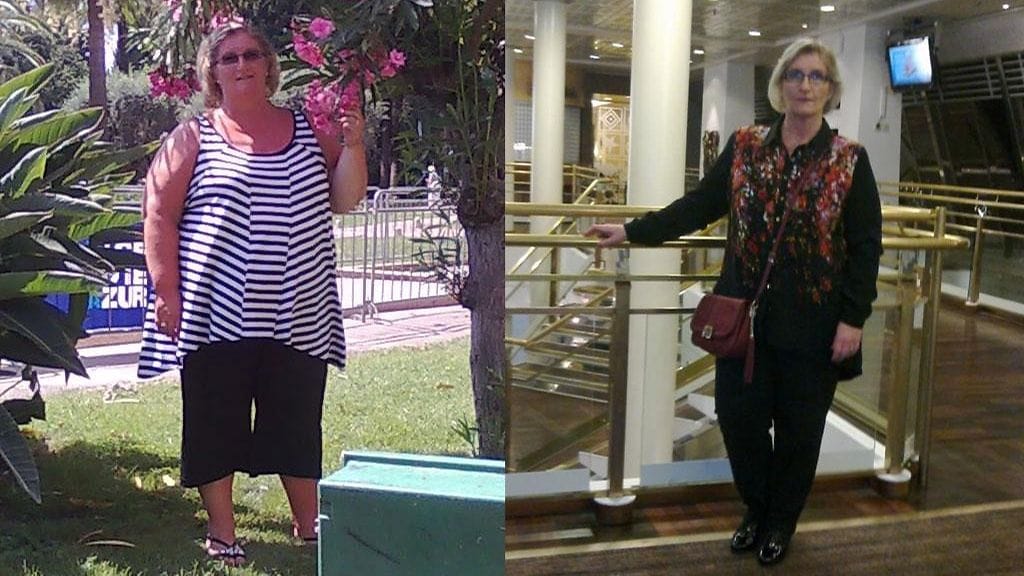 Vasemmalla Anne vuonna 2010, oikealla laihdutusurakan jälkeen.