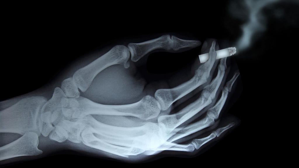 Tupakointi ei tee hyvää luille.