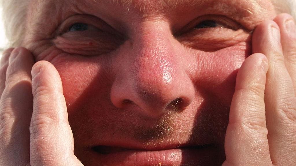 Alkoholi voi tuoda punan kasvoille. Kuvituskuva.