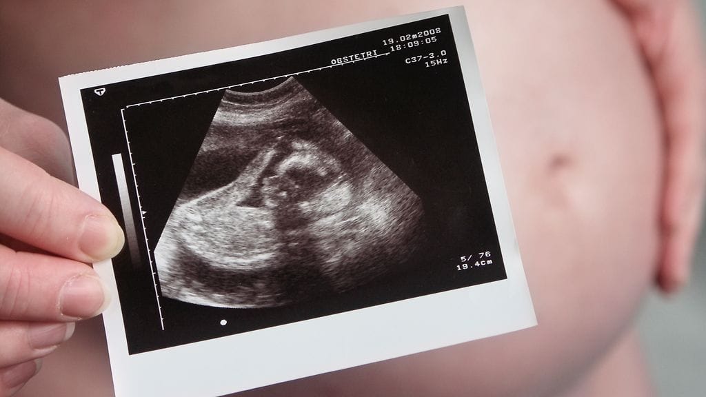 Tupakointi lisää terveyshaittoja.