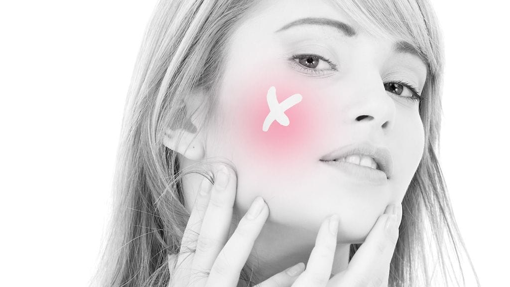 Perintötekijät ulkoisten tekijöiden ohella vaikuttavat ihon hyinvointii.