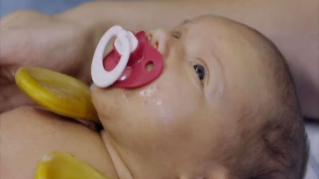 Pieniä potilaita -sarjan kolmannessa jaksossa nähtään mitä Sophia-vauvalle kuuluu.