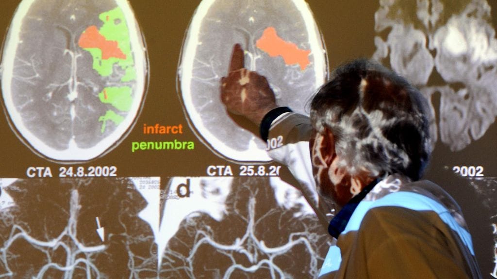 Kuvassa esitellään aivohalvauksen hoitoa. Kuvan henkilö ei liity haastatteluun.