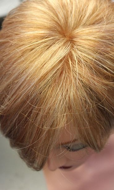 Laadukkaassa peruukissa hiukset näyttävät kasvavan luonnollisesti suoraan ihosta.