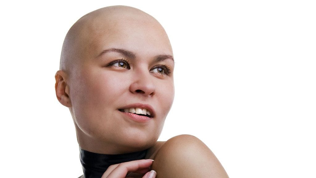 Hiustenlähdöstä kärsinyt asiakas on usein helpottunut, kun asian hoitaminen lähtee käyntiin.