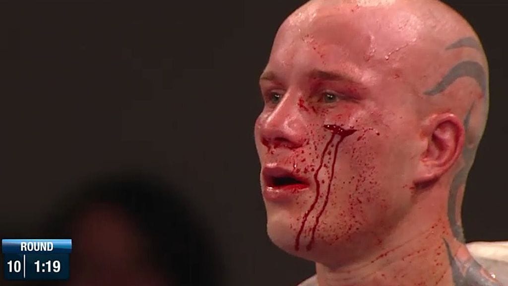 Ville Piispanen sai karun haavan poskeensa.