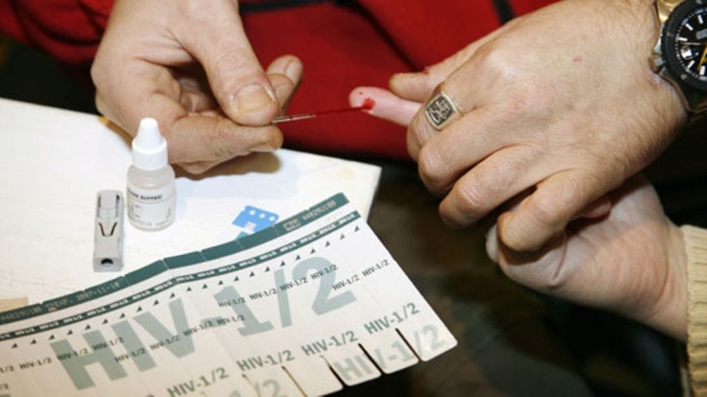hiv-testi (lehtikuva)