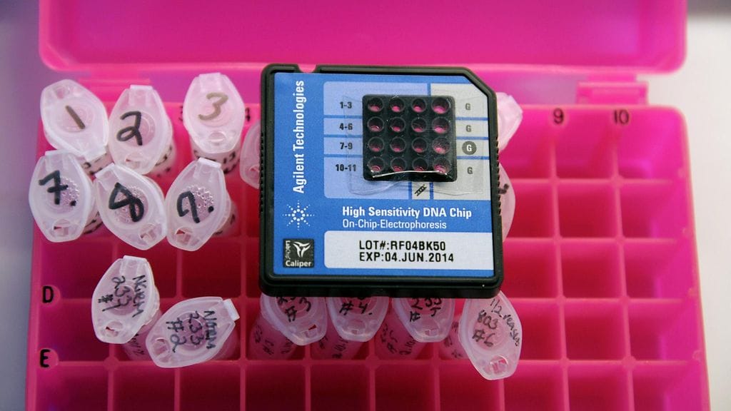 Syöpötapaukset lisääntyvät tulevaisuudessa, Suomen Syöpärekisteri ennustaa. Kuvassa syövän geenitestausta Huslabissa Helsingissä viime vuonna.