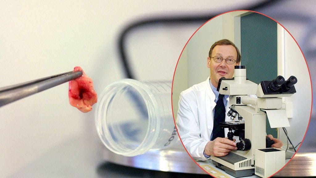 Professori Matti Haltian mukaan Creutzfeldt-Jakobin -taudilla ja hullun lehmän taudilla ei ole kuin luokittelullinen yhteys.