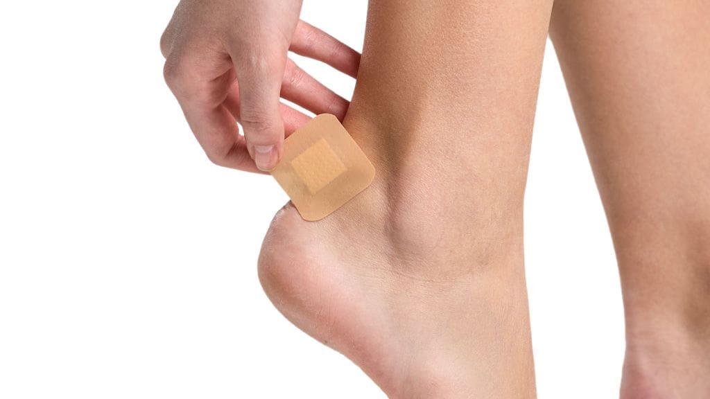 Kengän hiertämä rakko voi olla kivulias.