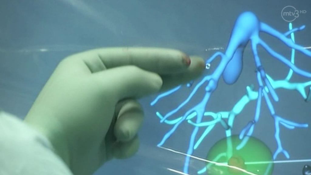 Kuvakaappaus MTV3:n Kymmenen uutisista 2. kesäkuuta 2014.