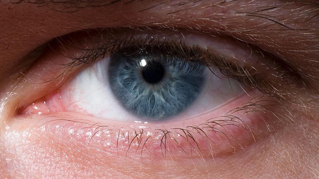 Lasiaisen irtauma on yleensä harmiton. Kuvituskuva.