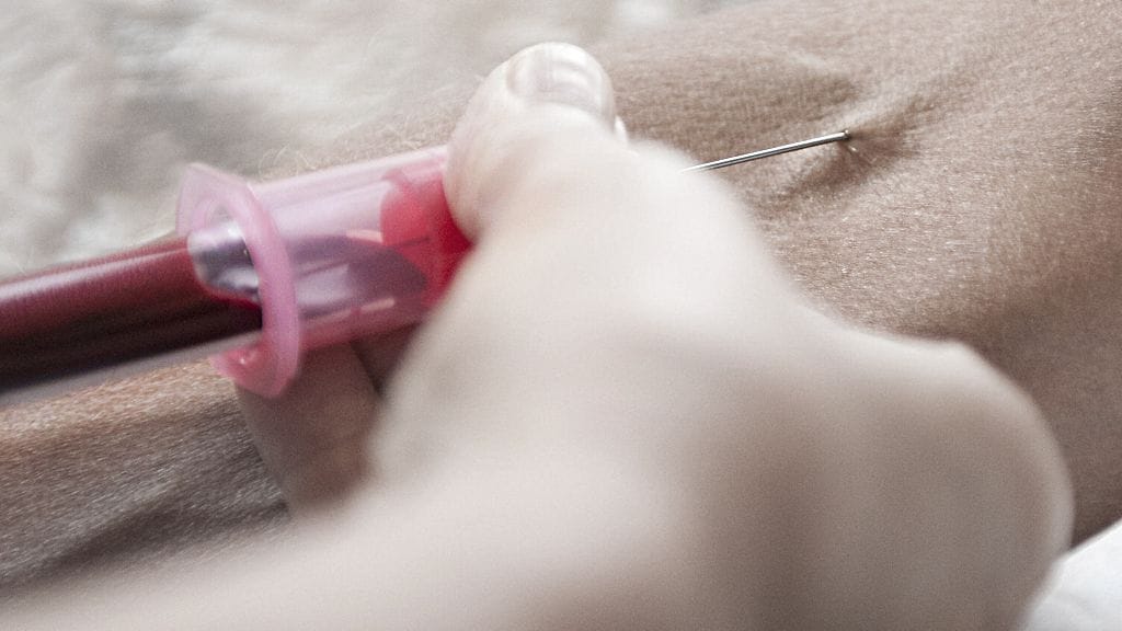 Biopankkeihin kerätään ihmisten kudos- ja verinäytteitä. Kuvituskuva.