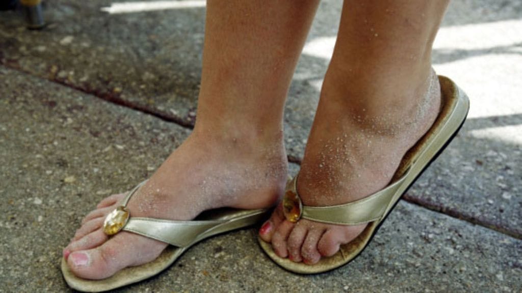 Varvastossuissa varmaat joutuvat koville. (Kuva: Sari Gustafsson / Lehtikuva.)