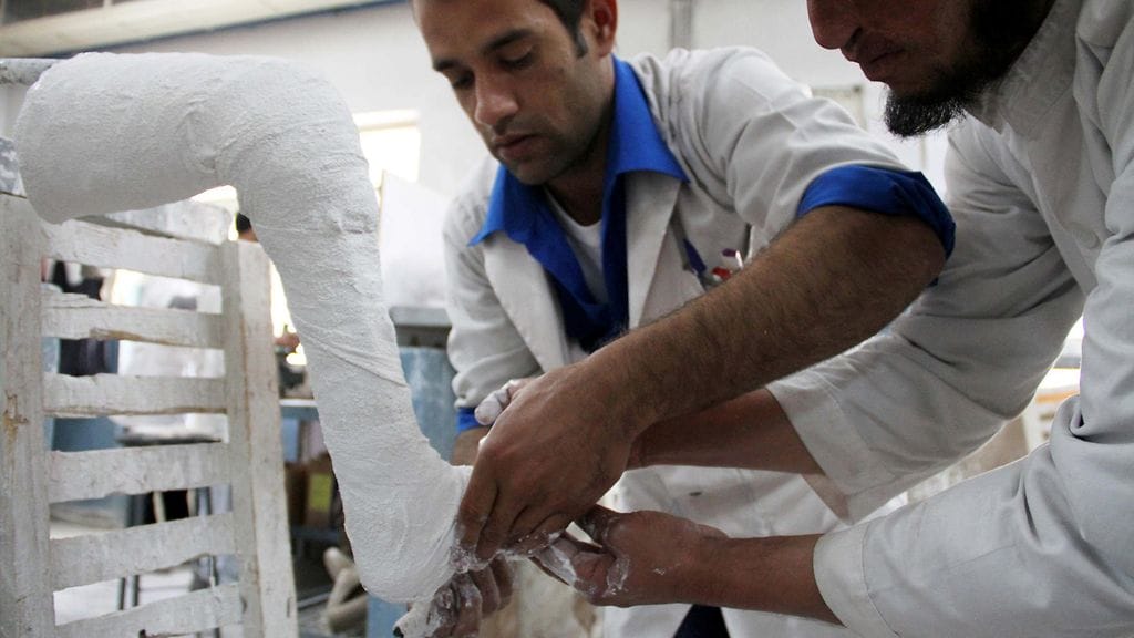 Vuosikymmenten taistelut Afganistanissa ovat luoneet kysynnän jalkaproteeseille. Kuvassa afgaanimiehet valmistavat proteesia Punaisen ristin tiloissa Kabulissa joulukuussa 2013.