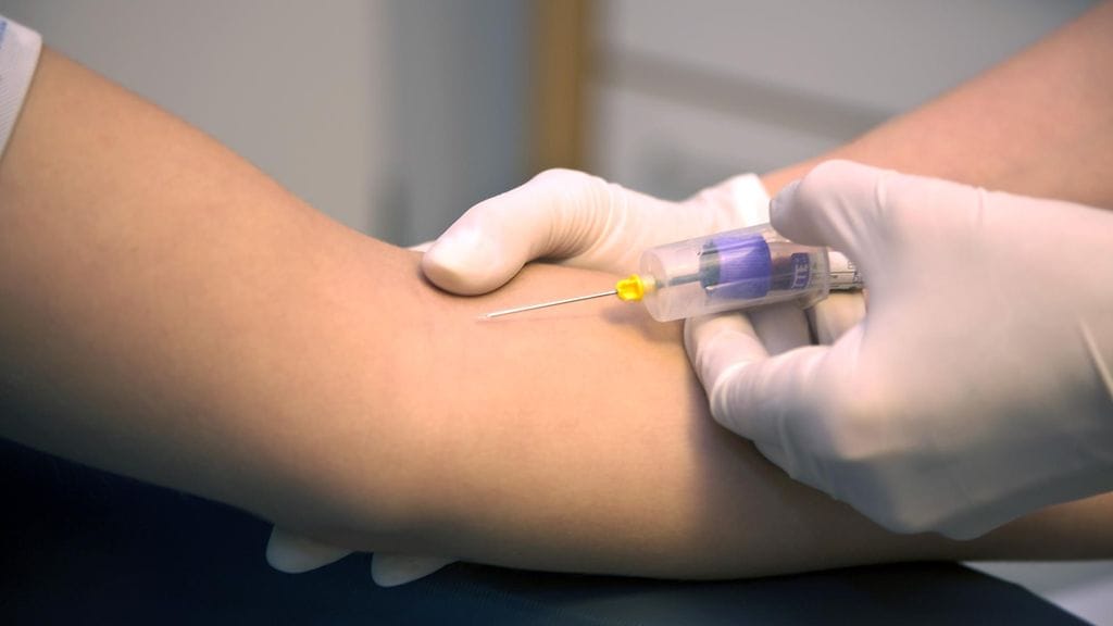 Milloin viimeksi olet mittauttanut kolesteroliarvosi?