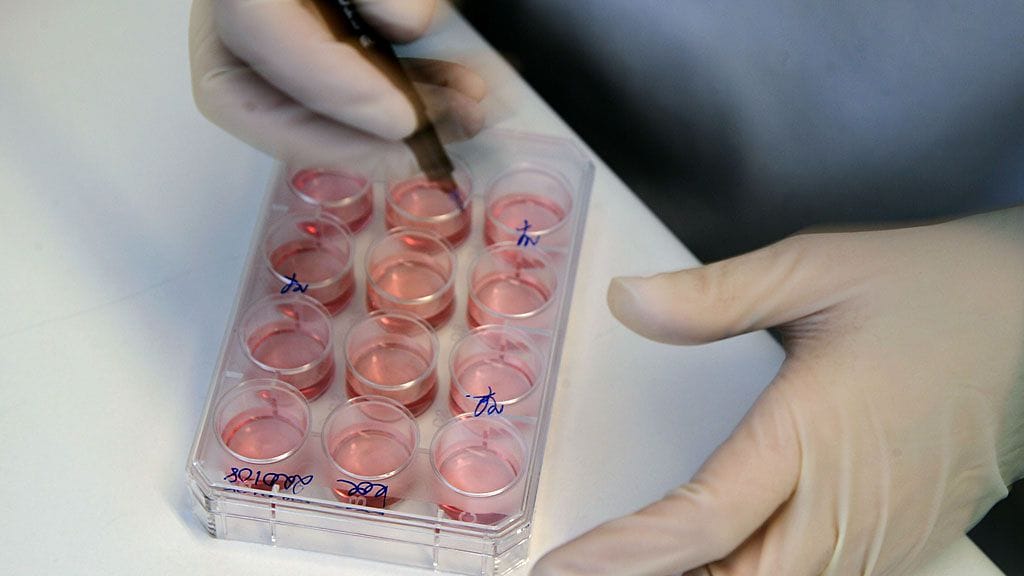 Tampereen yliopiston Regea -labrassa tehdään kantasoluteknologiaan liittyviä tutkimuksia.