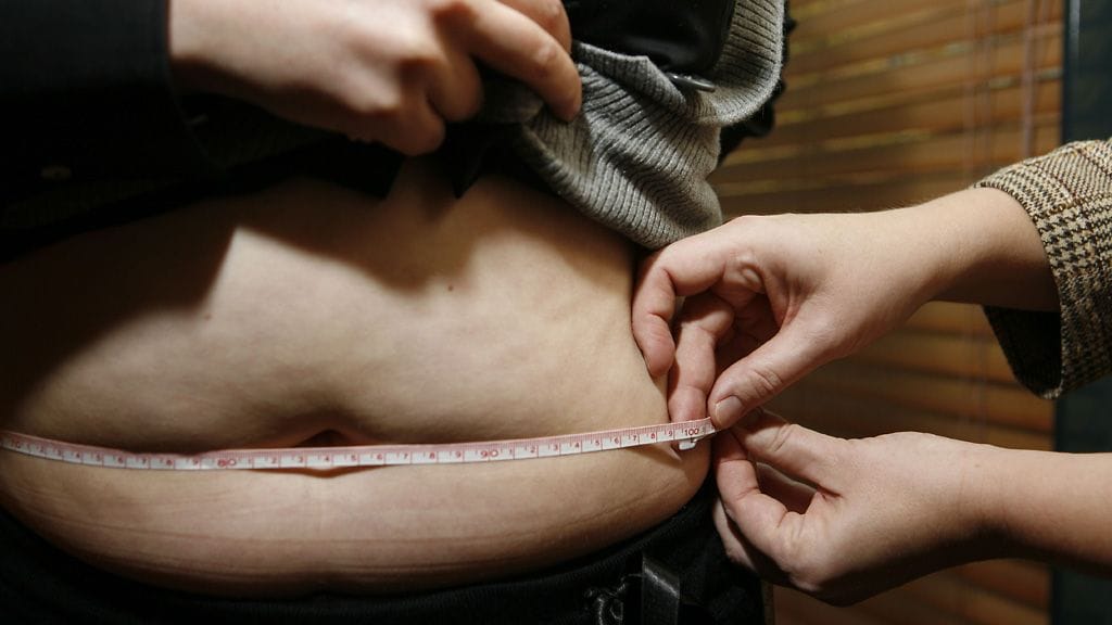 Syömishäiriöliitto korostaa, että jokaisen sairastuneen tilanne on erilainen, oli kyse sitten anoreksiasta, bulimiasta tai ahmintahäiriö BED:tä sairastavasta.