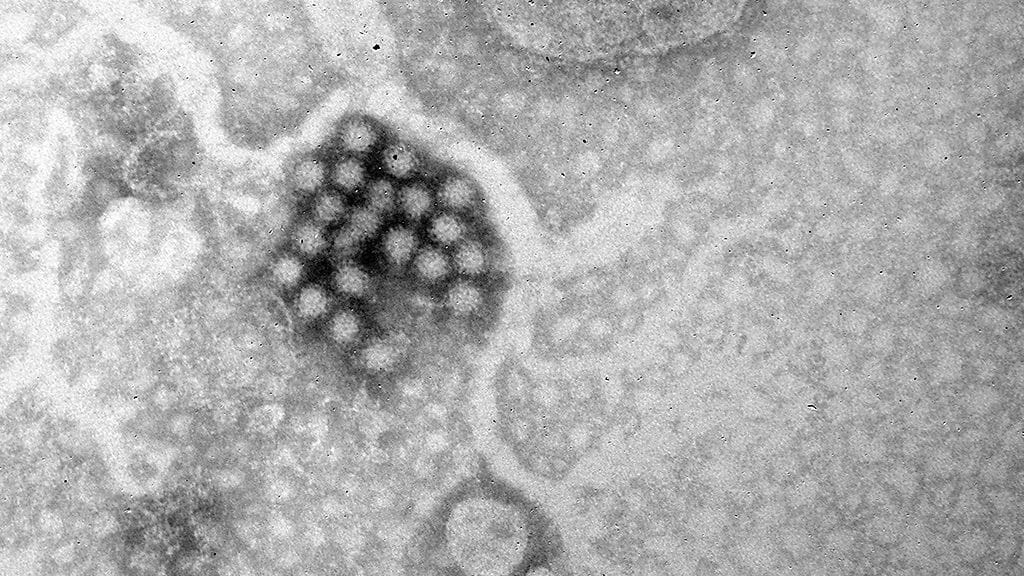 Yhdysvaltain tartuntatautivirasto on kehottanut raskaana olevia matkailijoia erityiseen varovaisuuteen.