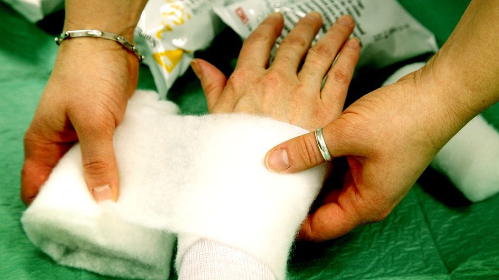 Kipsattu raaja on yksi keuhkoveritulpan riskitekijä. Kuvituskuva.