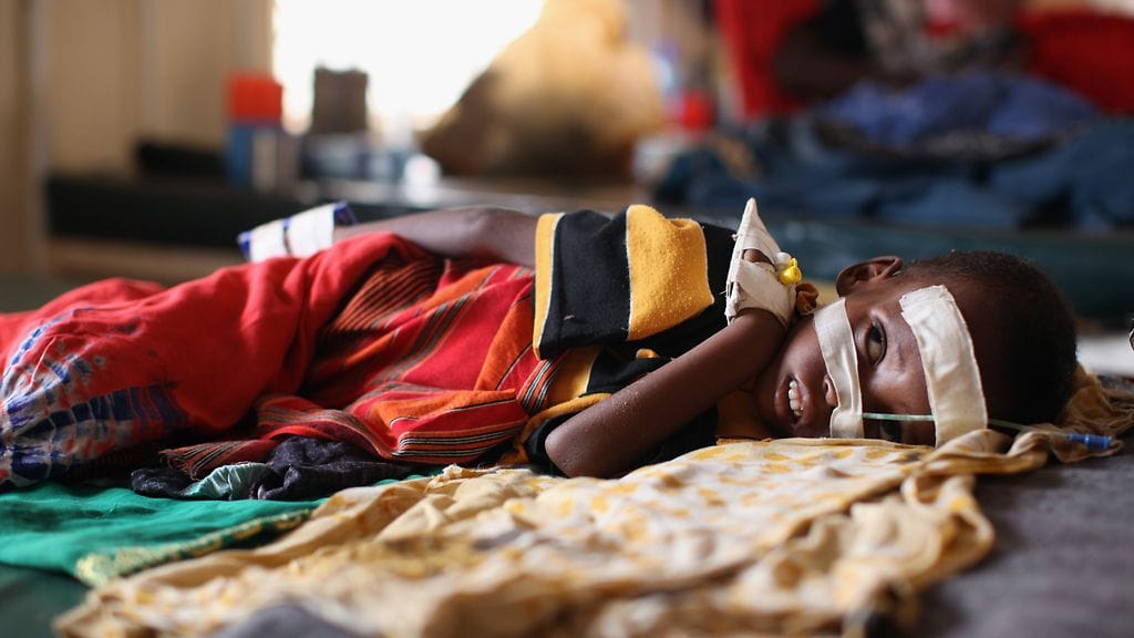 Aliravitsemuksesta kärsivä lapsi Dadaabin pakolaisleirillä Keniassa 19.7.2011.