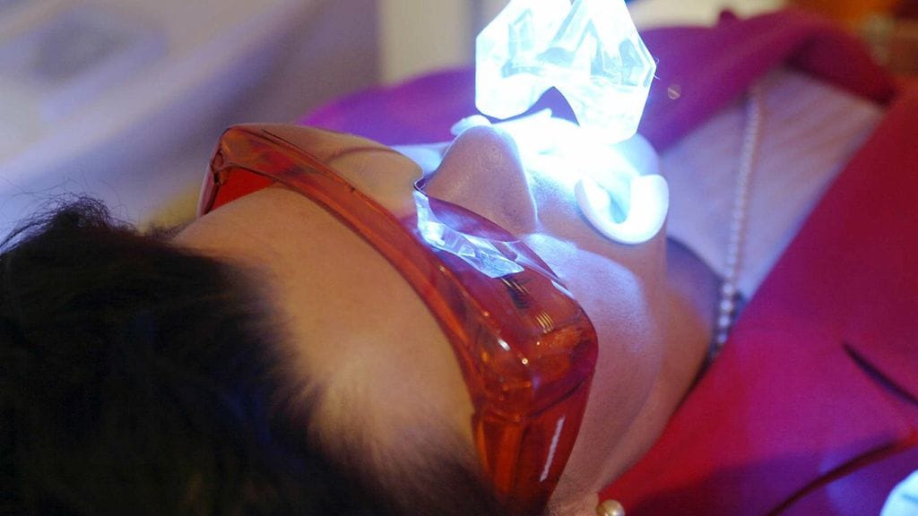 Tehokas hampaiden valkaisu ei ole riskitöntä.