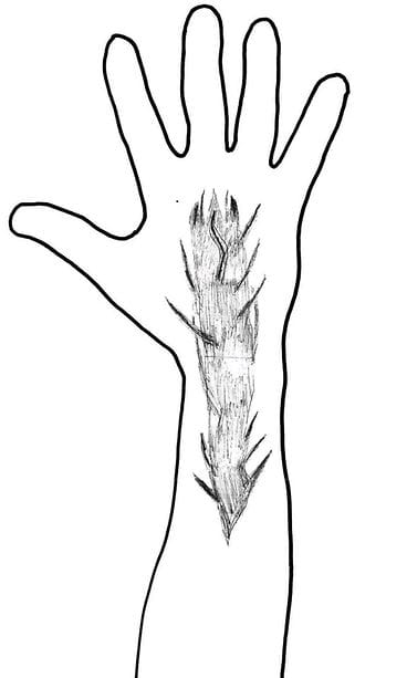 Lamminpää puukotus poliisi luonnos