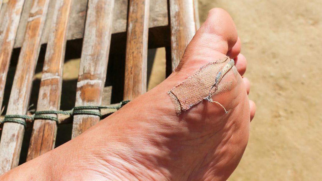 Haavat tulisi pitää puhtaana ja sitoa kunnolla, jotta ne eivät pääse tulehtumaan. Kuvituskuva.