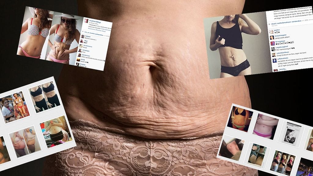 Naiset eri puolilla maailmaa ovat innostuneet ottamaan kuvia synnyttämisen muokkaamista vartaloistaan. (Kuva: All Over Press, Kuvakaappaukset: Instagram)