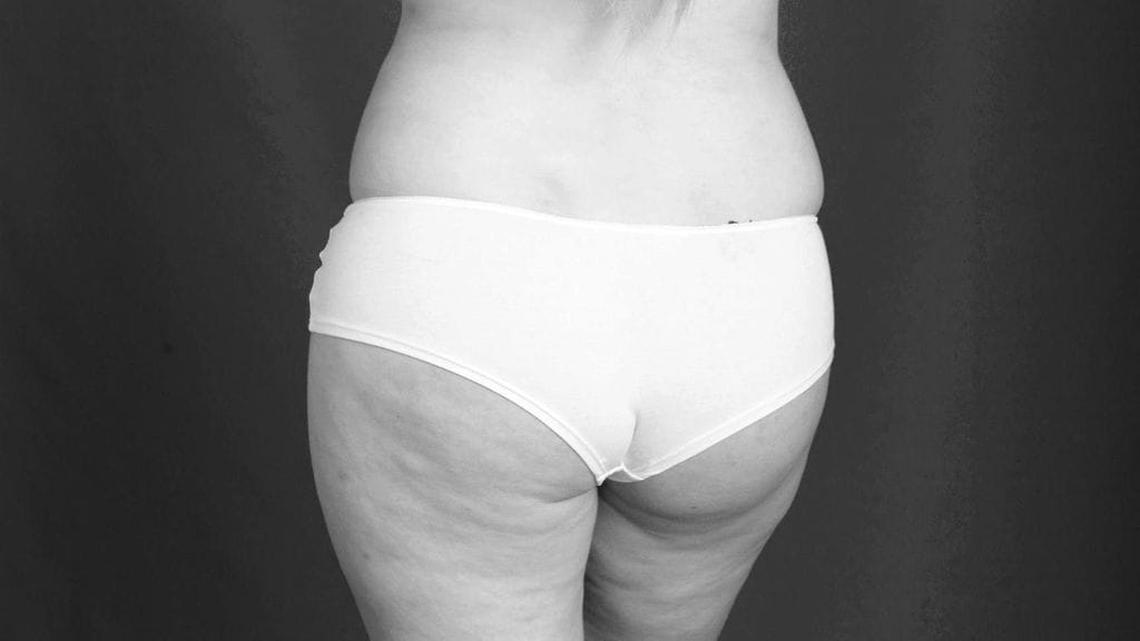 Peittävämmät pikkuhousut ovat muotitietoisen valinta.